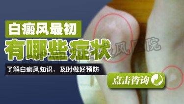 白癜风初有哪些症状？