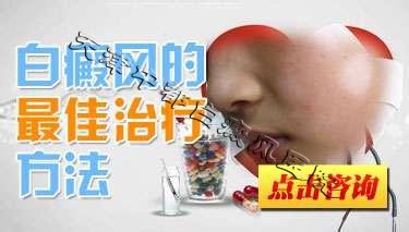 青少年白斑治疗的好方法