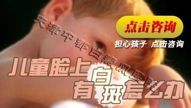 婴幼儿白斑要如何治疗