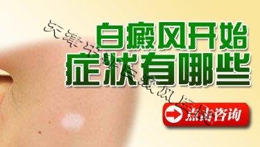 脸上不痛不痒的白斑是白癜风吗