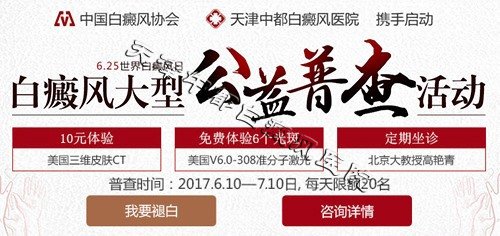 如何控制泛发型白癜风的发展？