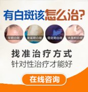 白癜风如何治疗好？