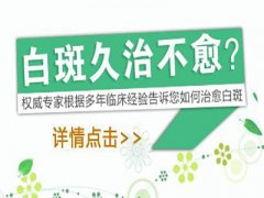 白癜风药物食用后会口干吗？